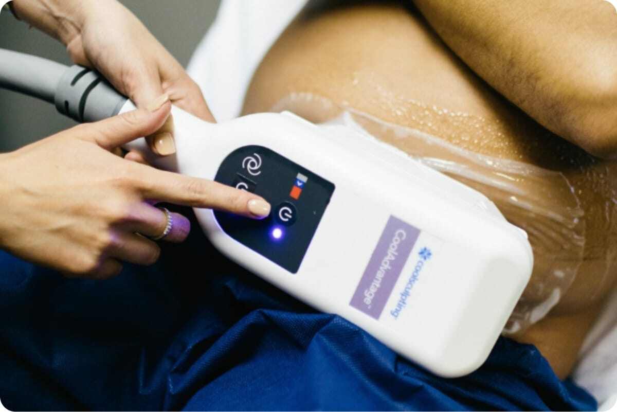 The Benefits of CoolSculpting: Non-Surgical Fat Reduction