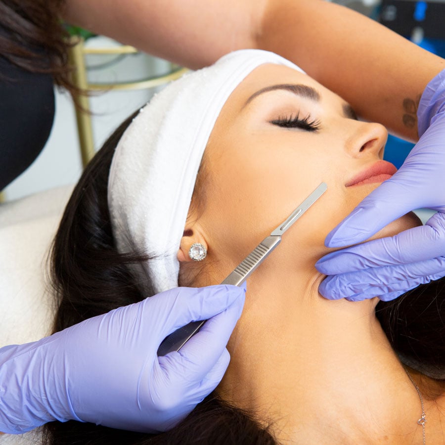 Dermaplaning in Vancouver - Skin Care - Skin Technique