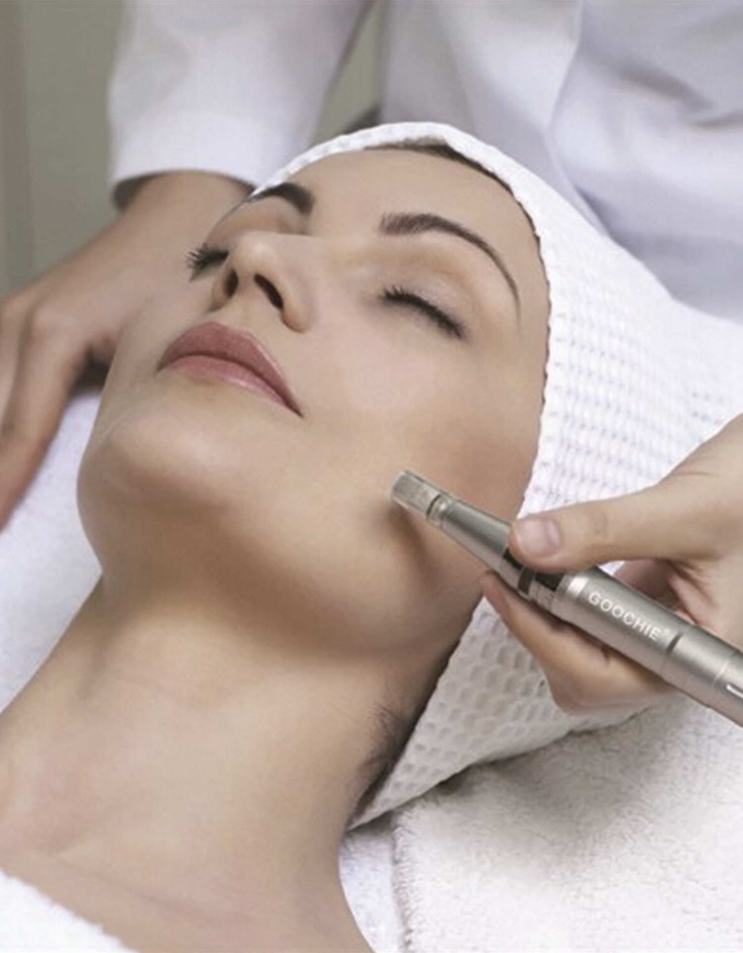 Acne clinic Vancouve