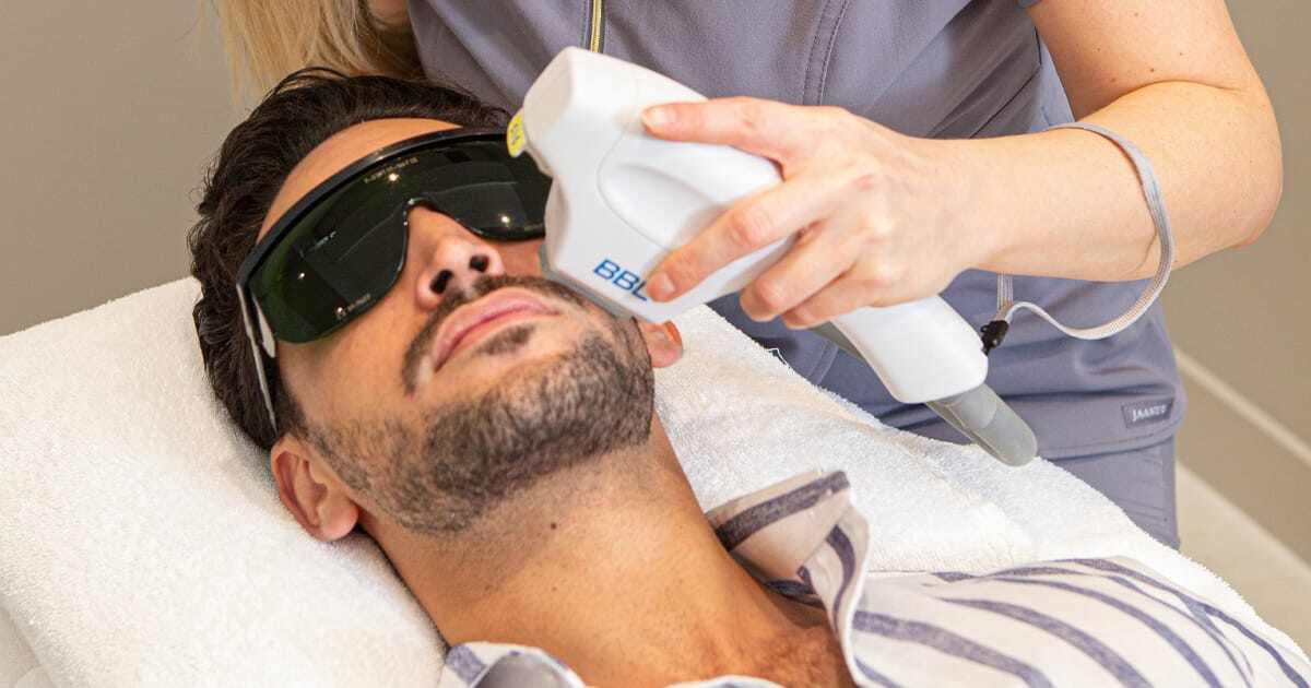 Yes, Laser Treatments are for Men Too