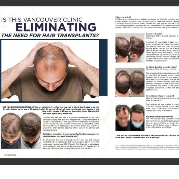 Is This Vancouver Clinic Eliminating the Need for Hair Transplants?